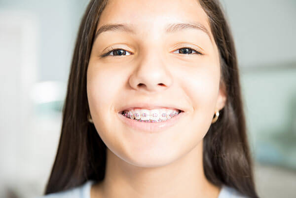 orthodontics for children - Orthodontics for children 1 - Orthodontics for Children