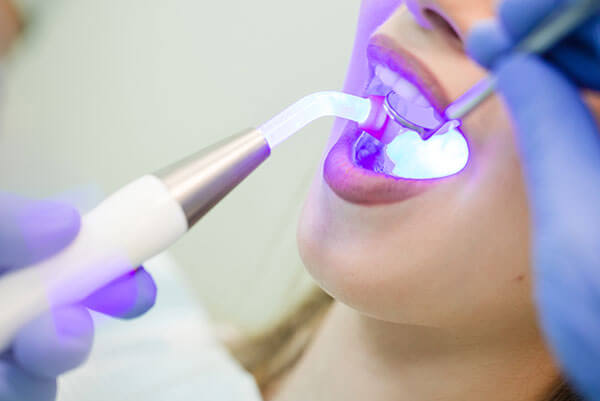 our services - restorative dentistry1 2 - Our Services